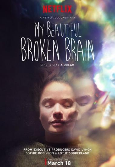 My Beautiful Broken Brain 2014